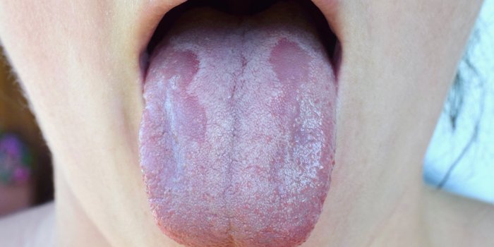 5 signes sur votre langue qui doivent vous alerter