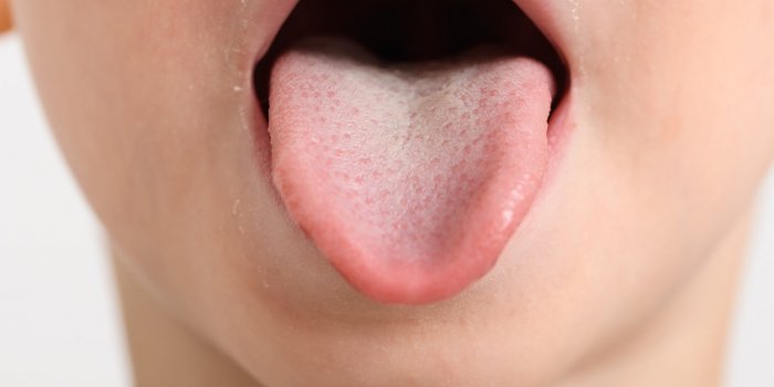 5 signes sur votre langue qui doivent vous alerter
