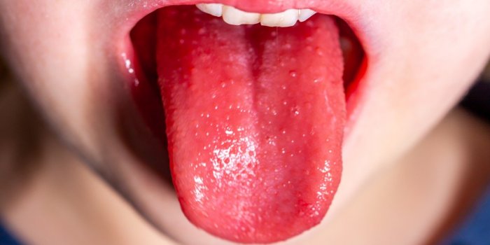 5 signes sur votre langue qui doivent vous alerter