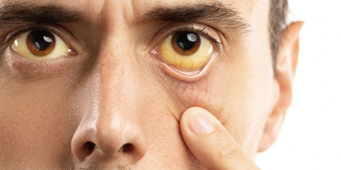 Circovirus : 5 symptômes du nouveau virus qui sâattaque au foie