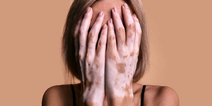 5 problèmes de santé que les cheveux blancs peuvent présager