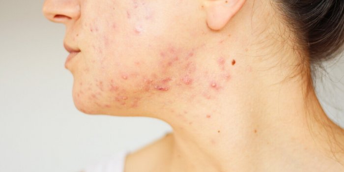 Masque visage Ã  LED : ses 5 bienfaits pour votre peau