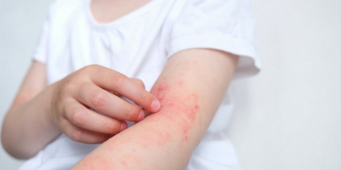 Visage : ce que vous devez arrÃªter de faire pour avoir une belle peau 