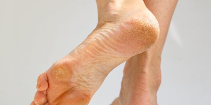 Ce que vos pieds rÃ©vÃ¨lent sur votre santÃ© selon un podologue
