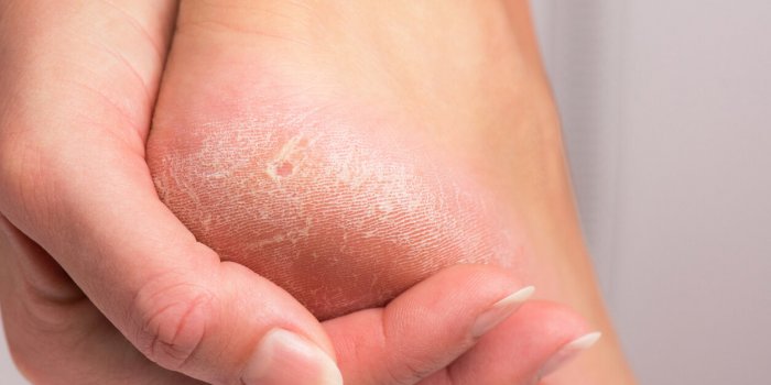 Ce que vos pieds rÃ©vÃ¨lent sur votre santÃ© selon un podologue