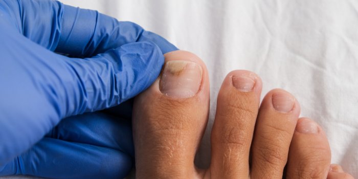 Ce que vos pieds rÃ©vÃ¨lent sur votre santÃ© selon un podologue