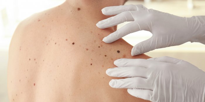 Bronzage : les 7 erreurs les plus dangereuses pour la santé