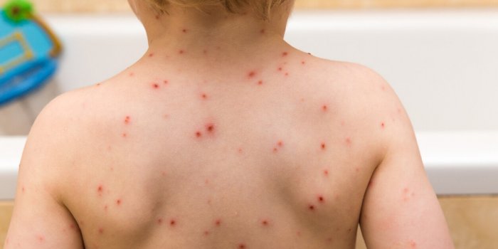 Grippe, Covid-19... : Quelles sont les maladies les plus contagieuses ?