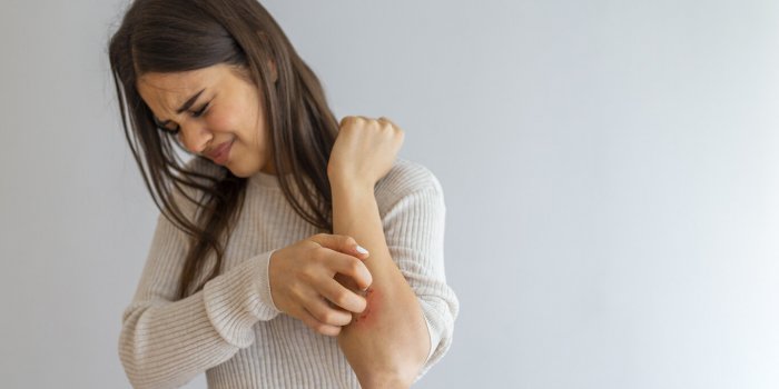 7 maladies favorisées par les acariens