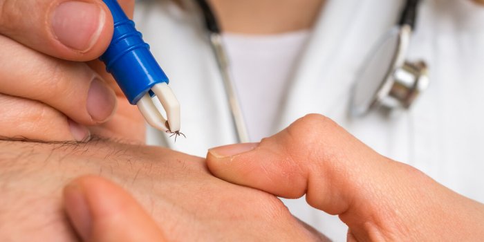 Sept erreurs à éviter absolument lors du retrait d'une tique