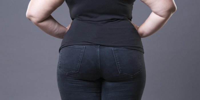 La liposuccion