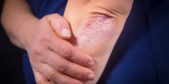 Ces 8 maladies sont associées à ce type d'aliments