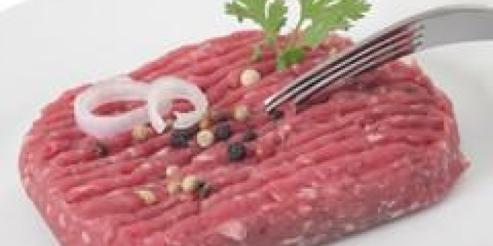 Alzheimer : une chercheuse en neurobiologie alerte sur les aliments ultra-transformés