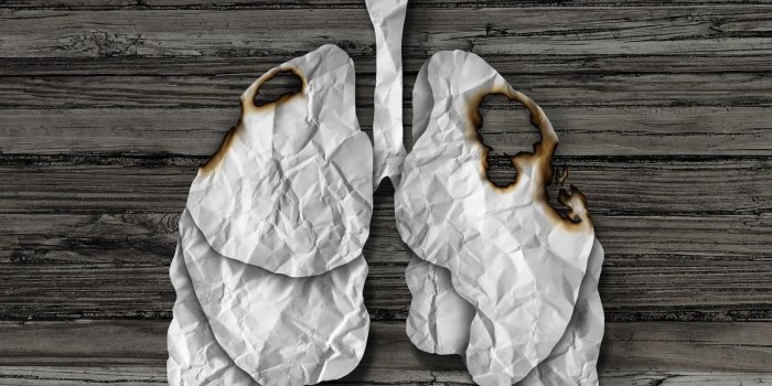 Embolie pulmonaire : 7 facteurs de risque Ã  connaÃ®tre