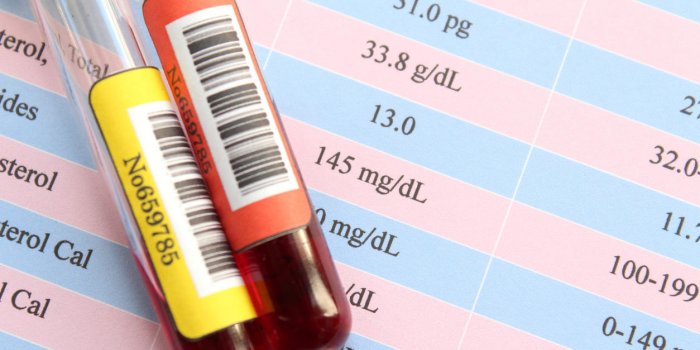 Myélome : 9 symptômes qui trahissent ce cancer de la moelle osseuse