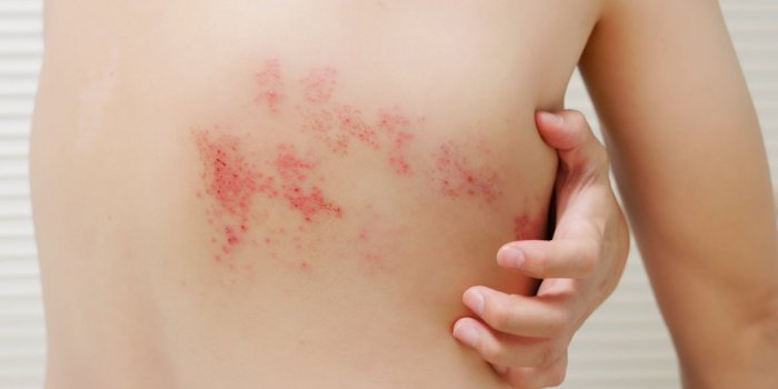 11 signes qui doivent alerter après avoir pris un médicament