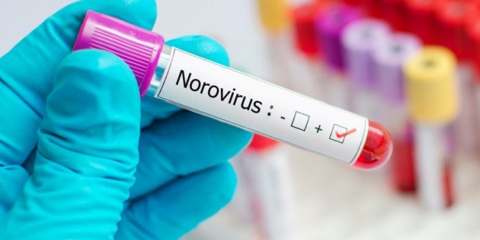 L'OMS identifie 17 vaccins Ã  dÃ©velopper en urgence