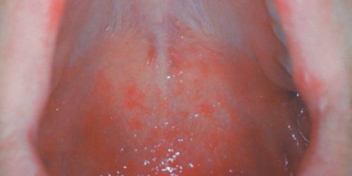 Coronavirus : 8 signes à repérer sur votre visage