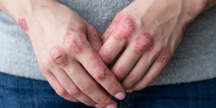 Ces 7 maladies physiques qui peuvent être provoquées par la trahison