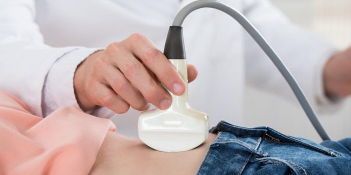 Les 11 précautions à prendre si vous avez un stérilet
