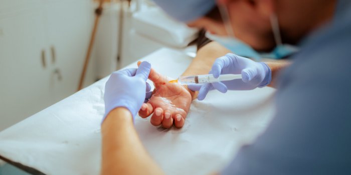 Les questions que les gens se posent sur lâanesthésie générale et locale