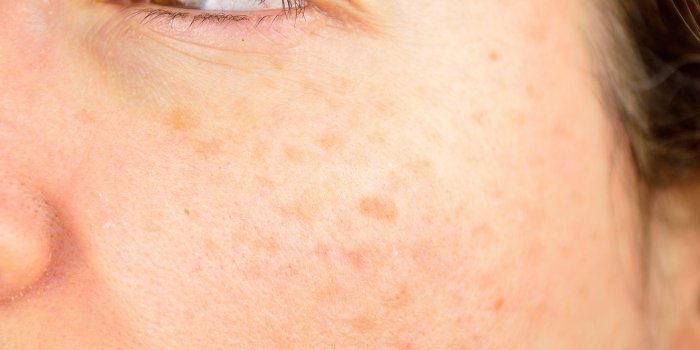 5 astuces pour une belle peau après 40 ans !