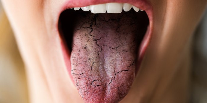 Canicule : 8 signes que vous ne buvez pas suffisamment dâeau