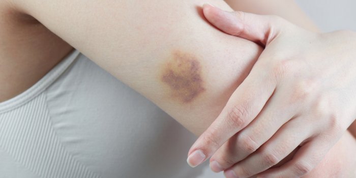 Vaccin Moderna : les effets secondaires les plus fréquemment observés en France