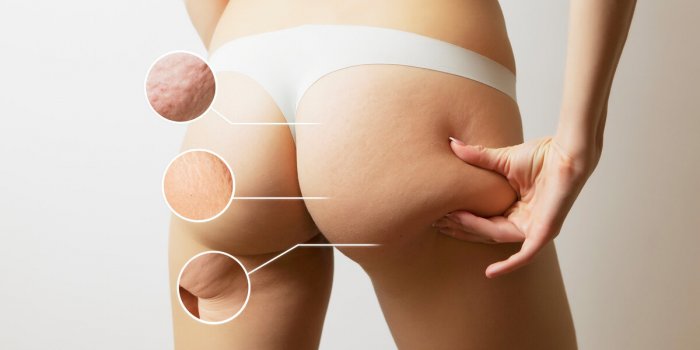6 techniques dâauto-massage anti-cellulite efficaces