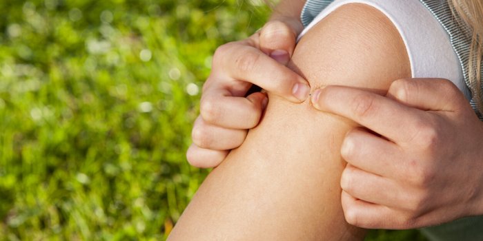 Sept erreurs à éviter absolument lors du retrait d'une tique