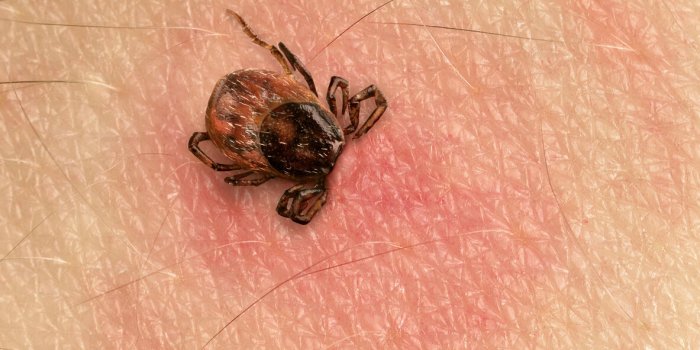 Sept erreurs à éviter absolument lors du retrait d'une tique