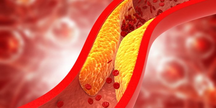 Curcuma : ses 15 bienfaits sur la santé