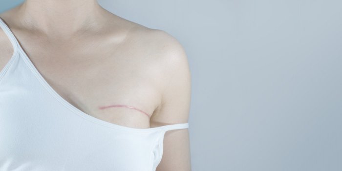 RÃ©gimes vegan, vÃ©gÃ©tarien : 6 maladies contre lesquelles ils vous protÃ¨gent