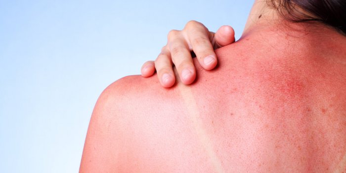 Ãté : 5 problèmes de santé courants à cette période