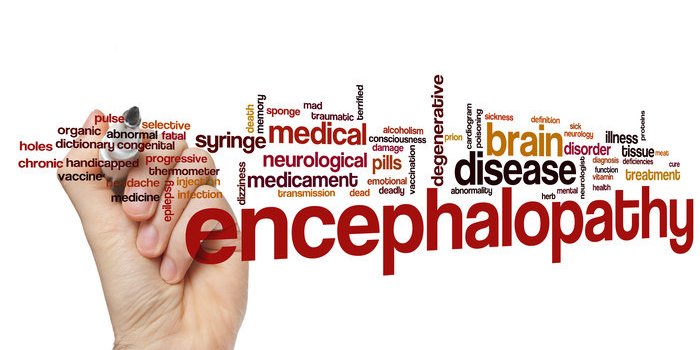 Covid : 13% des patients hospitalisÃ©s ont des symptÃ´mes neurologiques graves