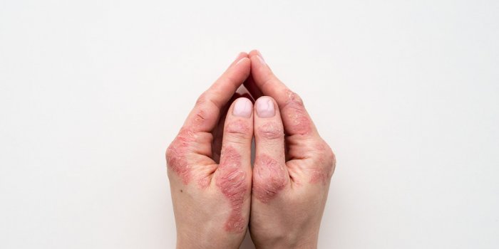 6 signes physiques que votre foie est fatigué