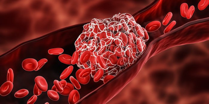 Vaccin Johnson & Johnson : Ã quels effets secondaires doit-on s'attendre ?