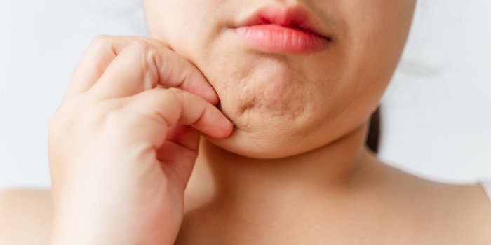 Les signes d'une thyroÃ¯de malade Ã  repÃ©rer