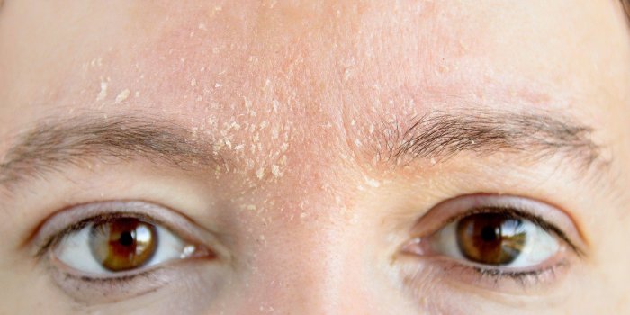 Carence en vitamine A : 8 signes que vous en manquez
