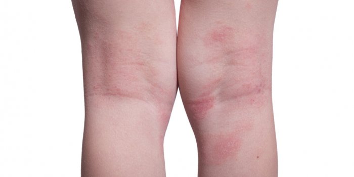 Quelles maladies soigne l'amoxicilline ?