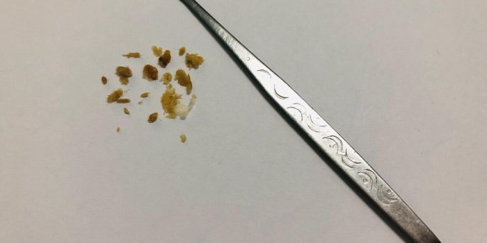Oreilles : les gestes Ã  ne surtout pas faire