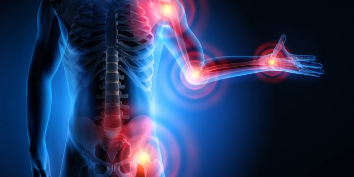 8 idées reçues sur lâarthrite quâil faut arrêter de croire