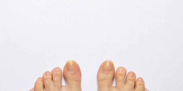 Ongles : ce que leur couleur signifie de votre état de santé