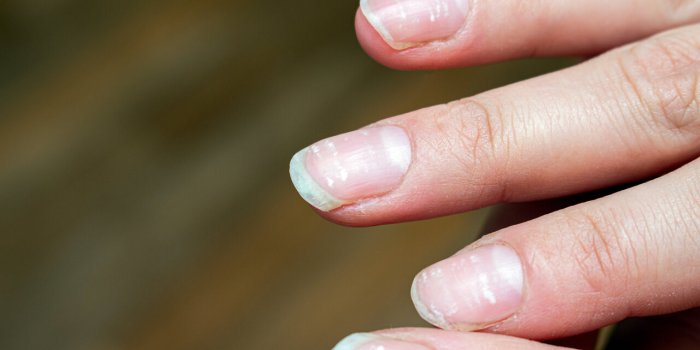 Ongles : ce que leur couleur signifie de votre état de santé