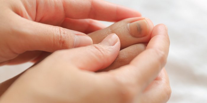 Ongles : ce que leur couleur signifie de votre état de santé