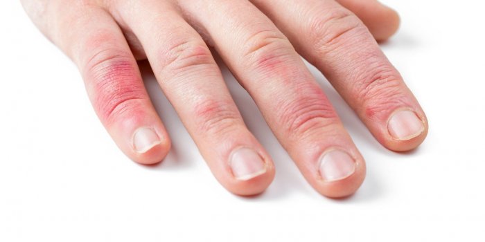 Covid-19 : certains symptômes prouvent que vous avez une forte immunité