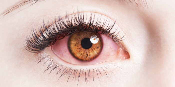 Coronavirus : 8 signes à repérer sur votre visage