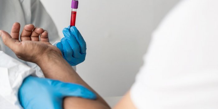 Ces dix analyses de sang oÃ¹ il faut Ãªtre Ã  jeun et pourquoi 