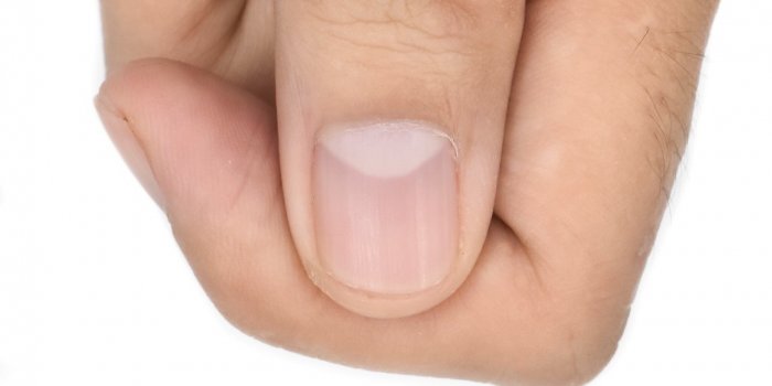 Pour savoir si vous avez vaincu la Covid-19, regardez vos ongles
