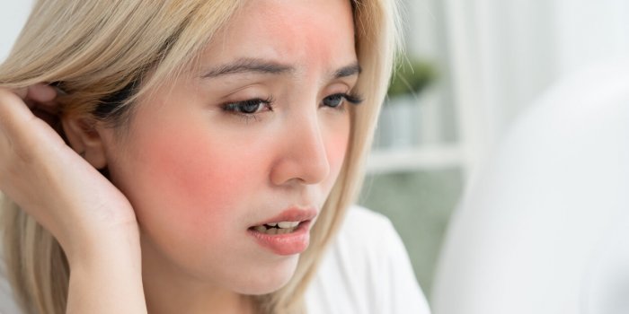 7 causes probables de la couperose sur votre visage